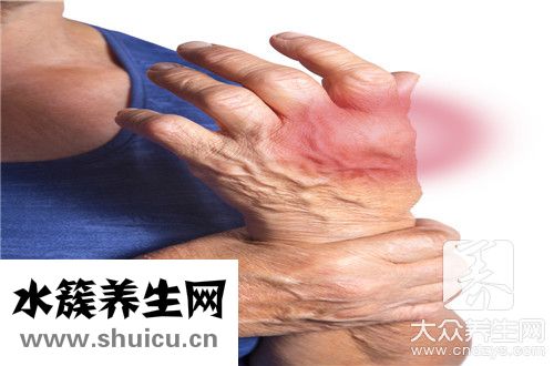 什么是类风湿