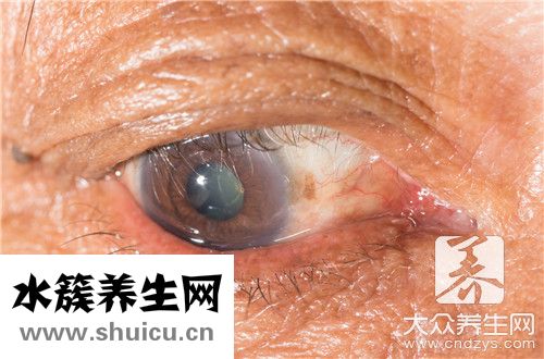 右眼下面一直跳