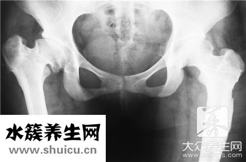 电刺激盆底肌治疗危害