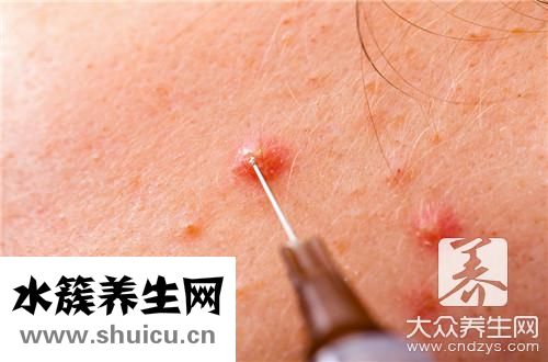 吃什么食物散结节最快