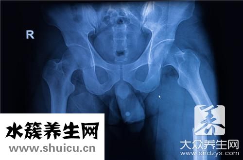 电刺激盆底肌治疗危害