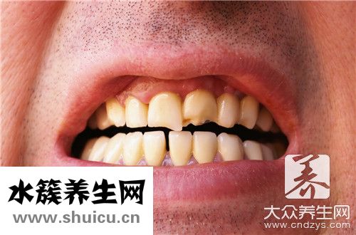 牙周炎牙齿松动办