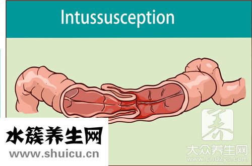 肠镜多久出结果