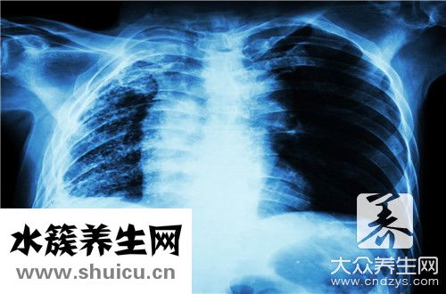 钙化灶治疗