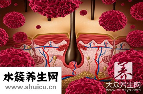毛囊炎涂什么药膏最好