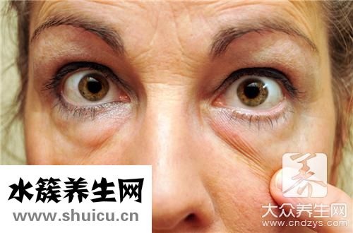 眼带用什么方法消除