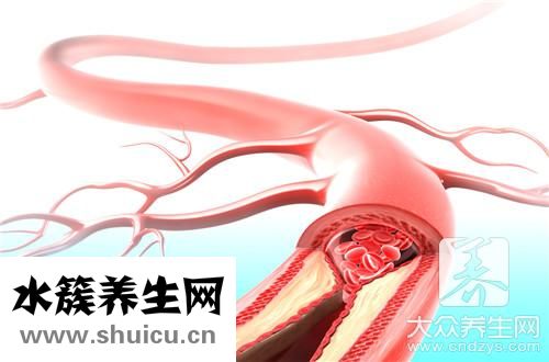血管堵了什么能通开