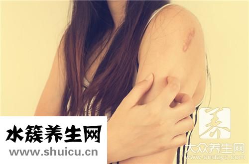 多形性红斑同