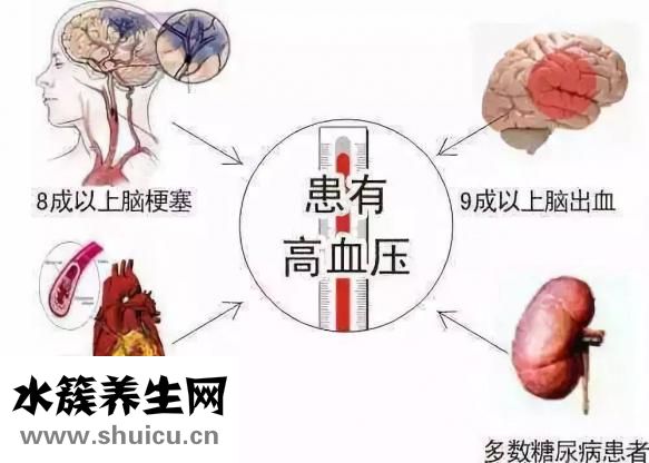 缺血性中风