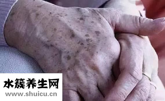 烟酰胺核糖（烟酰胺核糖对皮肤的作用）