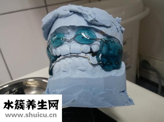 牙齿矫正器有用吗