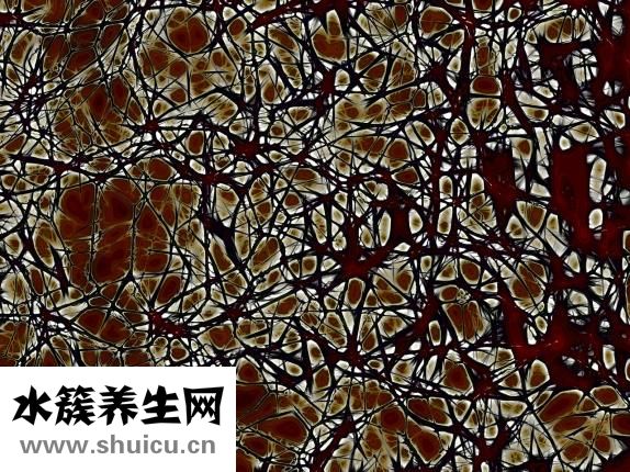 大脑镰钙化（大脑镰钙化有什么坏处）
