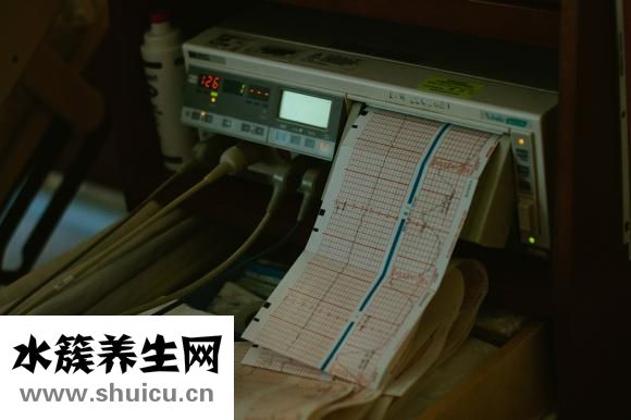 心电监护电极位置