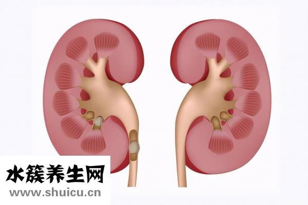 体外碎石费用