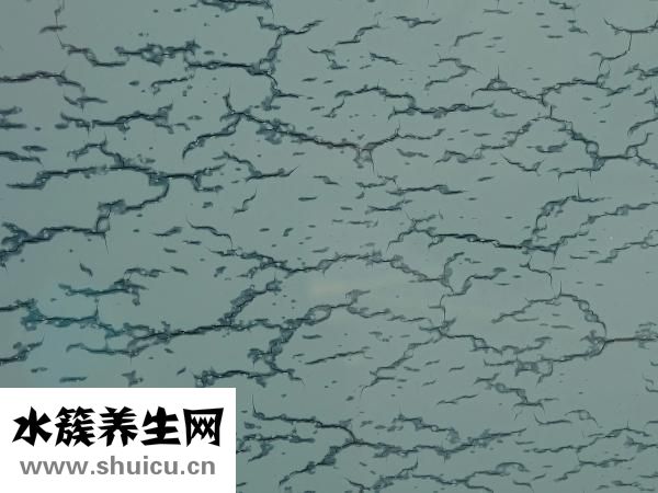 帕金森综合征