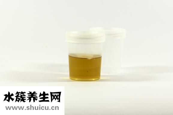 尿检怎么看