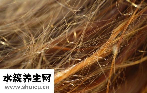 头皮屑多又痒怎么办
