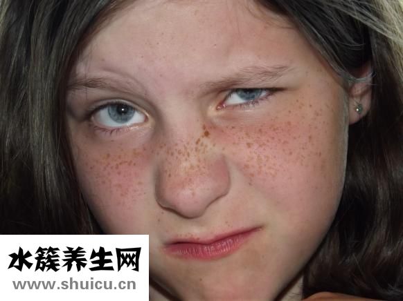 笑纹怎么去除
