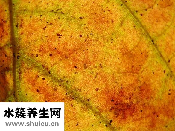 扩张性心肌病
