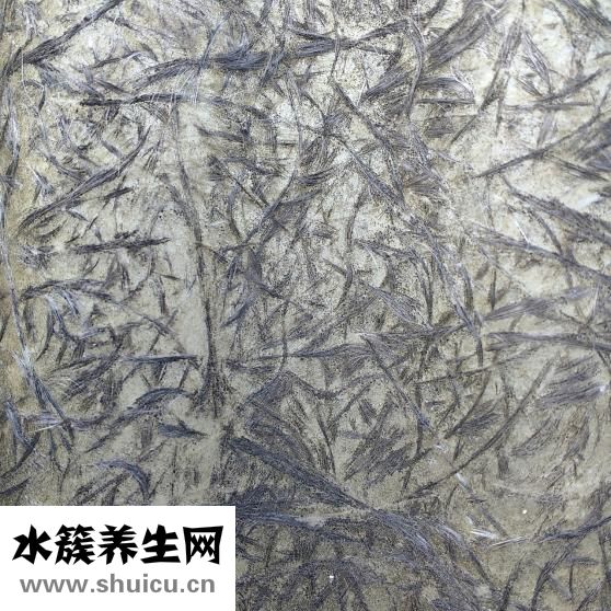 纤维囊性乳腺病