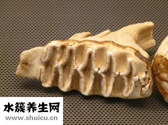 隐形牙套多少钱