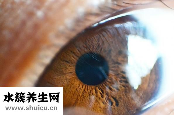 新生儿黄疸怎么办