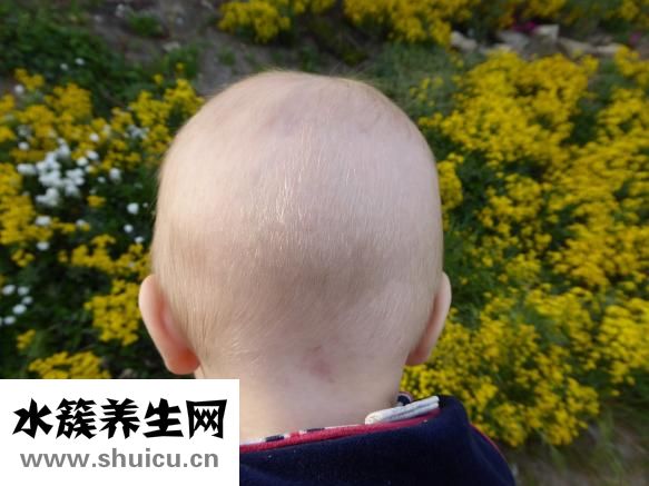 小儿咳嗽有痰怎么办