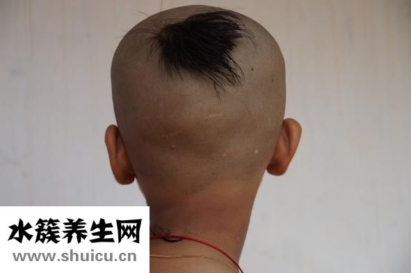 皮肤毛孔大怎么办