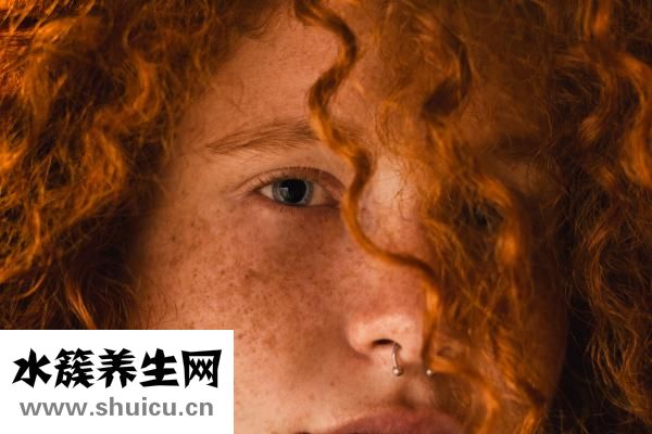 皮肤有红血丝怎么办