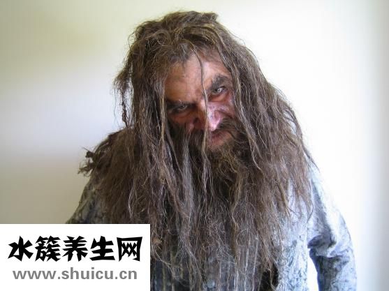 新生儿头皮屑怎么弄