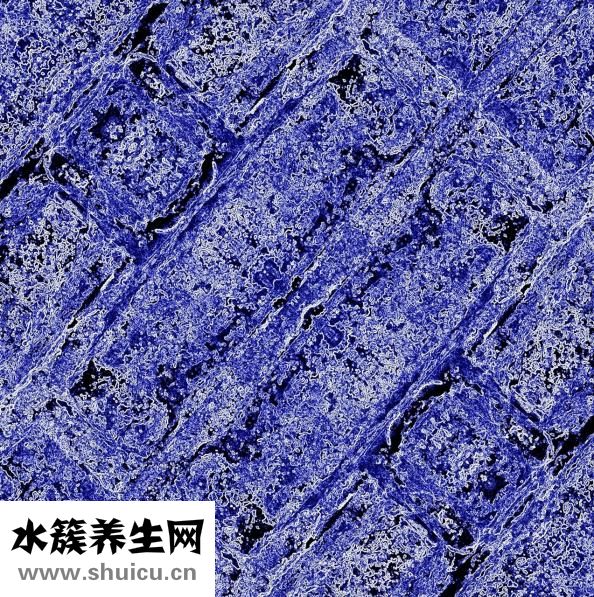 怎么知道角质层厚