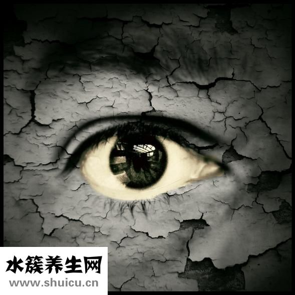 宝宝斗鸡眼怎么矫正