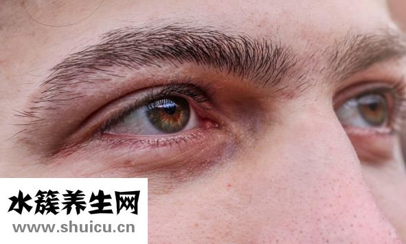 出绝眼怎么办