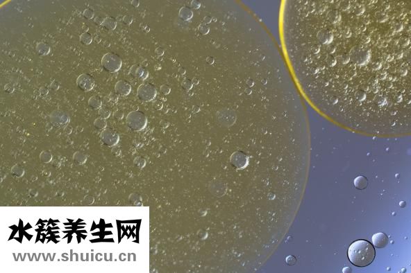 头皮总出油怎么办