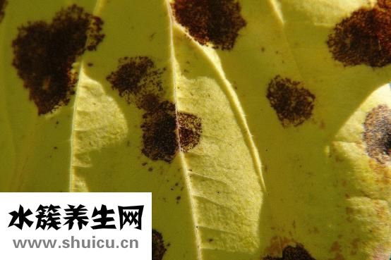黄斑瘤怎么治疗