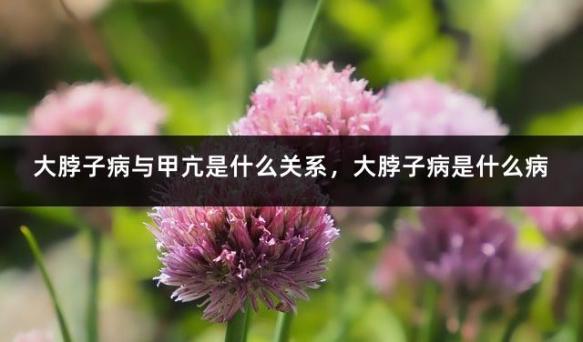 大脖子病与甲亢是什么关系，大脖子病是什么病