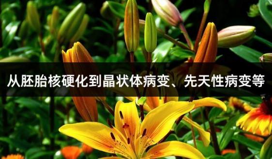 从胚胎核硬化到晶状体病变、先天性病变等