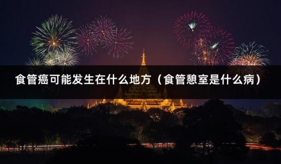 食管癌可能发生在什么地方（食管憩室是什么病）
