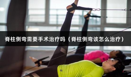 脊柱侧弯需要手术治疗吗（脊柱侧弯该怎么治疗）