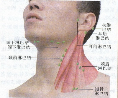 淋巴结是怎么回事，脖子上长个包是怎么回事？