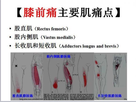 找准股内侧肌的酸胀感有助预防肌肉萎缩