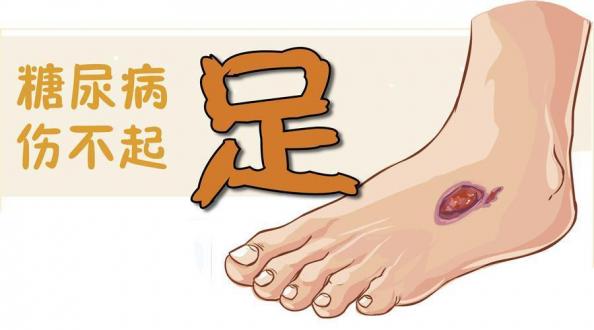 糖尿病足的治疗，得了糖足怎么治疗全身治疗