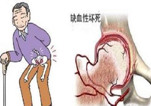 小灰泰迪双侧股骨头坏死怎么回事？
