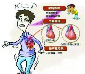 轻度心肌炎5个早期症状，轻度心肌炎5个早期症状吃什么药