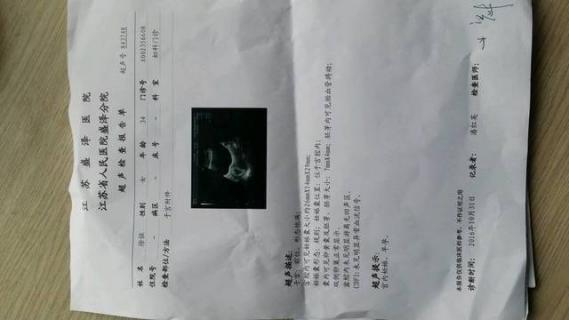 检查输卵管是否堵塞做什么检查最好（检查输卵管是否堵塞做什么检查）
