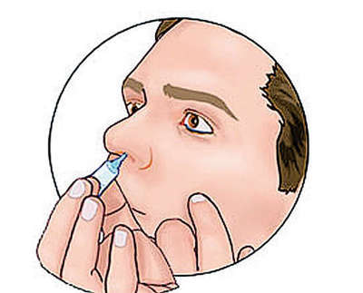 鼻咽癌前期的18种预兆有哪些（鼻咽癌前期的18种预兆）