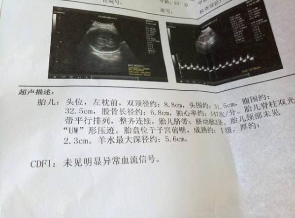 打一个月的胎儿要多少钱呢（打一个月的胎儿要多少钱）