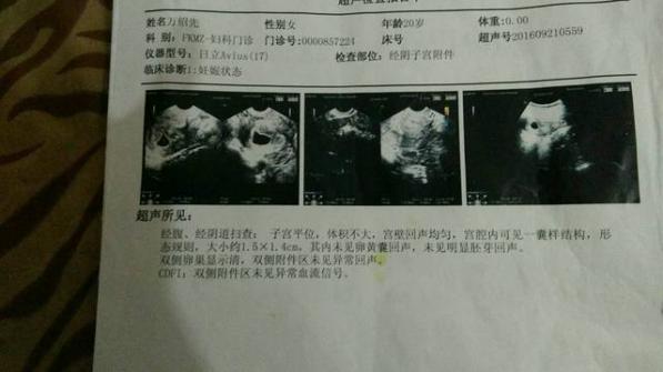 怀孕一周有没有什么征兆（怀孕一周有什么现象）