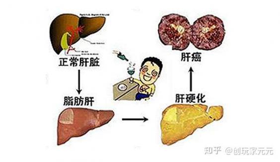 肝出现问题有哪些信号（肝脏疾病有哪些症状）