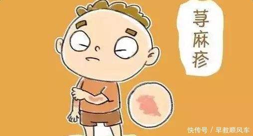 食物过敏多久会自行消退（过敏多久会自行消退）